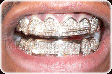 Grillz the bar and grill guy's smile!